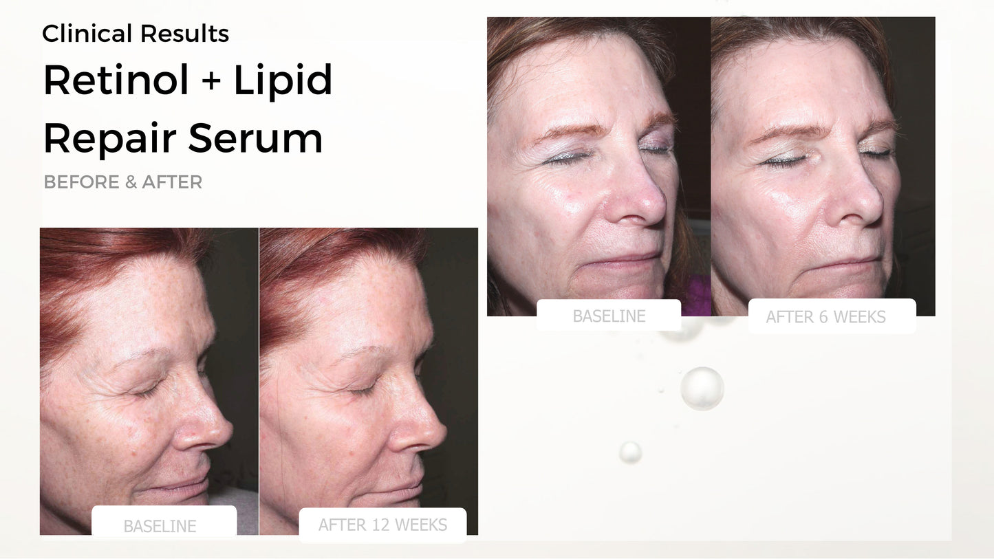 Retinol + Lipid Repair Serum