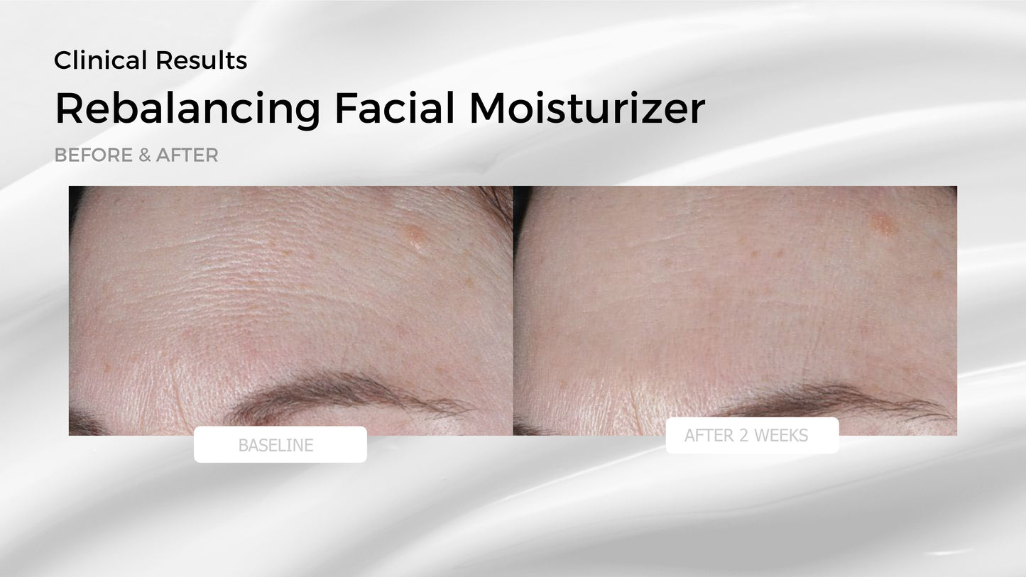 Rebalancing Facial Moisturizer