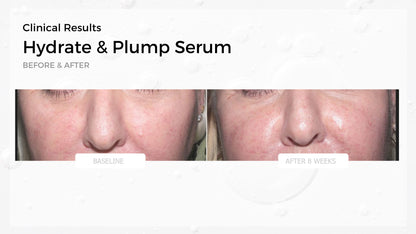 Hydrate & Plump Serum